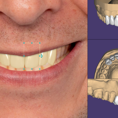 TianaDENT, produs pentru tehnică dentară